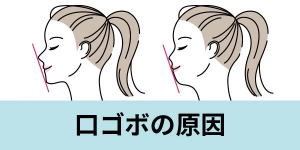 口コボ　原因