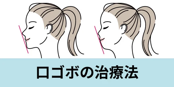 口ゴボ　治療法