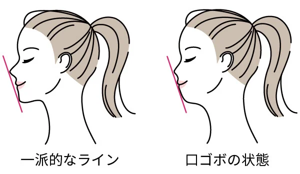 口ゴボ　一般　比較