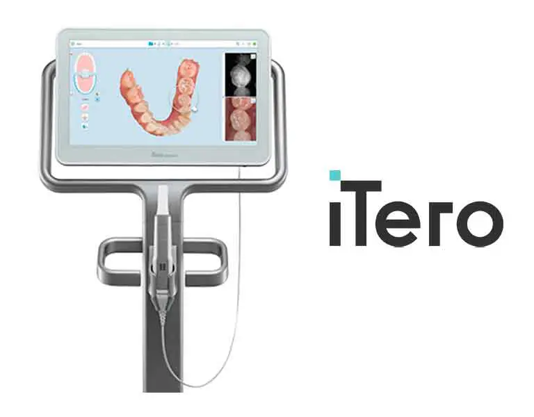 01.jpg | ルーチェマウスピース矯正歯科 iTero elementによる3D光学スキャン