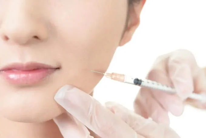 033 | ルーチェマウスピース矯正歯科 ③施術