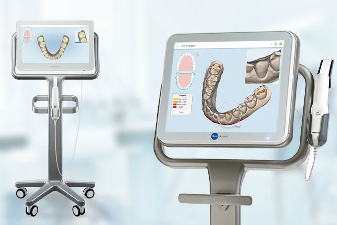 3-3d | ルーチェマウスピース矯正歯科 ③写真撮影・3Dスキャン