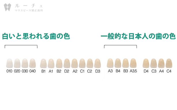 999 | ルーチェマウスピース矯正歯科 どれくらいトーンアップする?