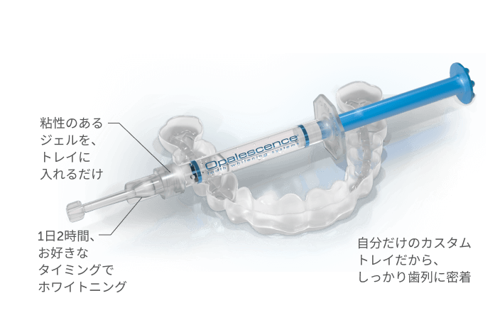 image_opalescence_pf_japan_callouts | ルーチェマウスピース矯正歯科 ホームホワイトニング