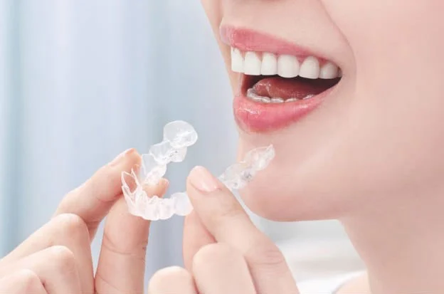 img_04-1 | ルーチェマウスピース矯正歯科 マウスピース矯正の効果を向上させる