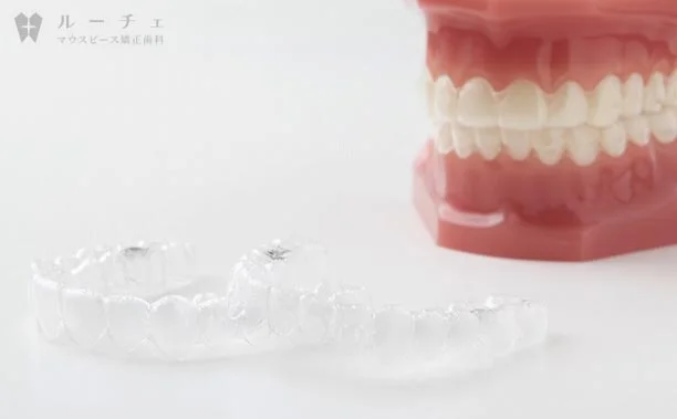 image | ルーチェマウスピース矯正歯科 マウスピース矯正がおすすめ