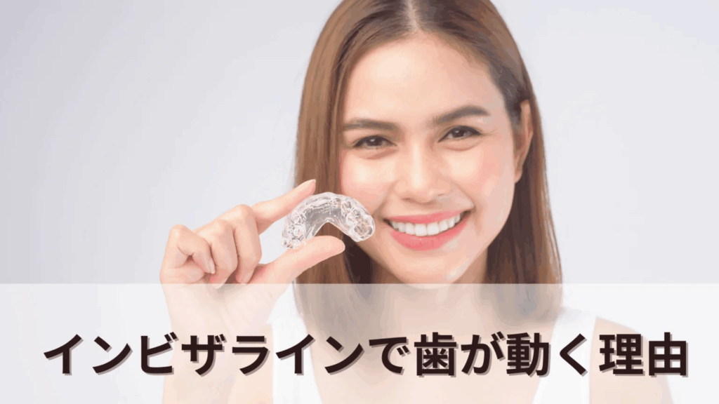 image | ルーチェマウスピース矯正歯科 インビザラインで歯が動く理由