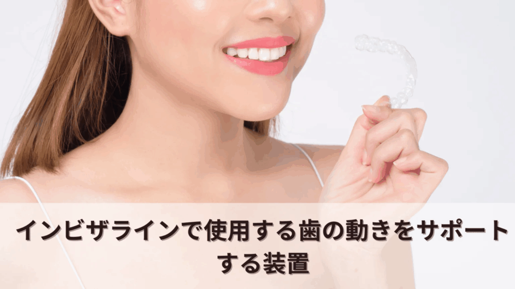 image | ルーチェマウスピース矯正歯科 インビザラインで使用する歯の動きをサポートする装置