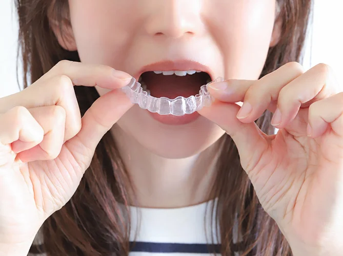 インビザラインはこんな人におすすめ