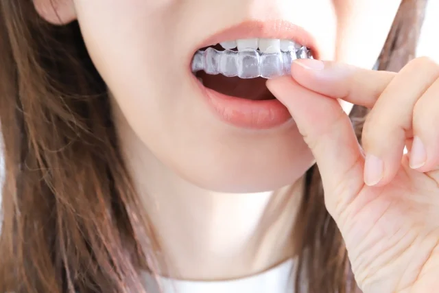 image | ルーチェマウスピース矯正歯科 リテーナーの装着期間について