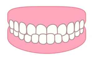 image | ルーチェマウスピース矯正歯科 下顎前突(かがくぜんとつ/いわゆる受け口)