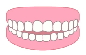 image | ルーチェマウスピース矯正歯科 開咬(かいこう)