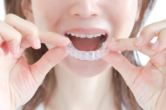 image | ルーチェマウスピース矯正歯科 「平均保定期間」