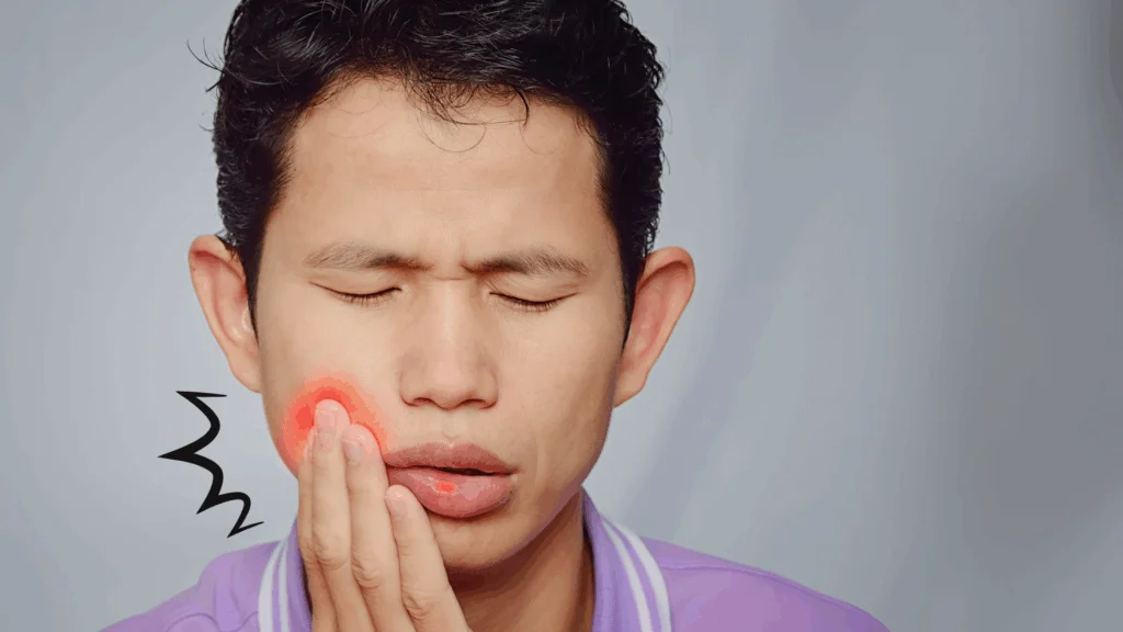 image | ルーチェマウスピース矯正歯科 インビザライン治療中に口内炎ができる原因とは?