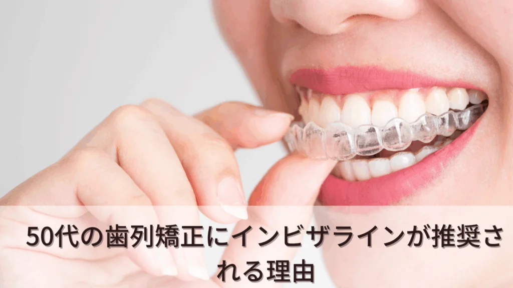 50-orthodontics-5 | ルーチェマウスピース矯正歯科 50代 矯正 インビザライン
