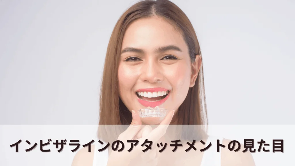 attachment-2 | ルーチェマウスピース矯正歯科 インビザライン アタッチメント 見た目